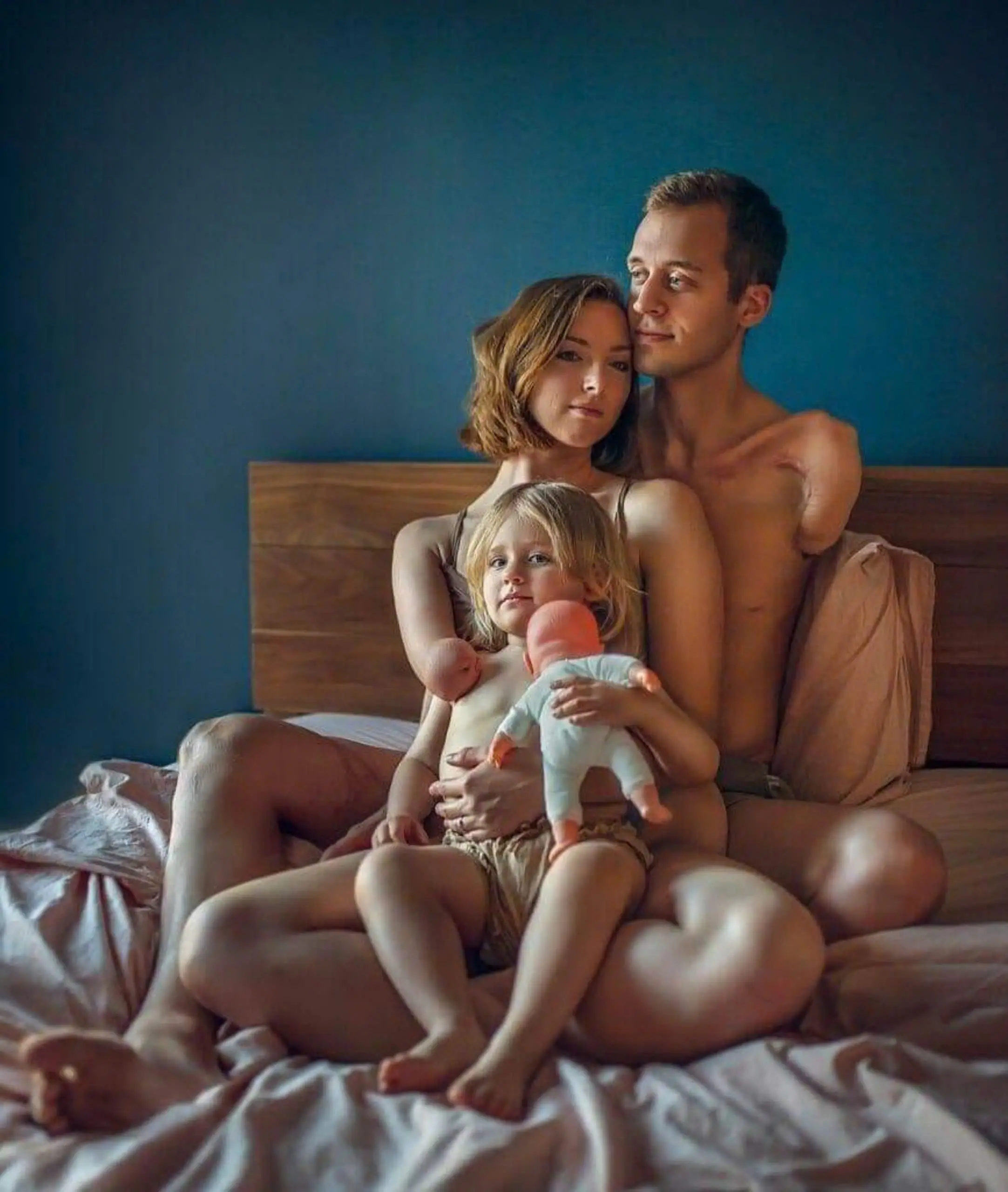 Sweet Happiness of a Couple with One Arm Amputated and Their Lovely Daughter