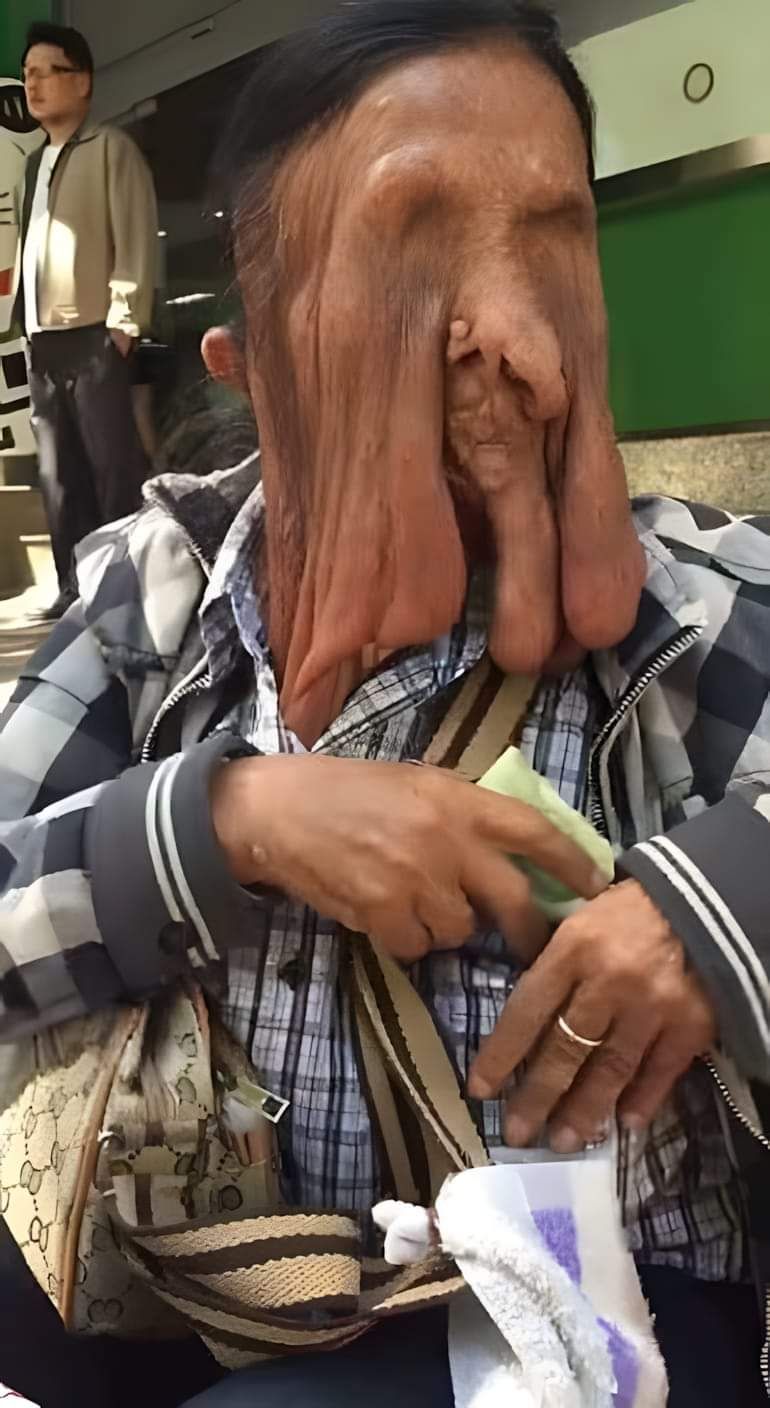 Hidden Corners of Life: The Story of a Man with a Sagging Face and His Struggle for Survival